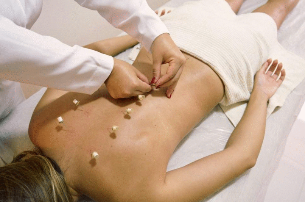 Acupuncture Near Me? Why Local Matters for Long-Term Relief